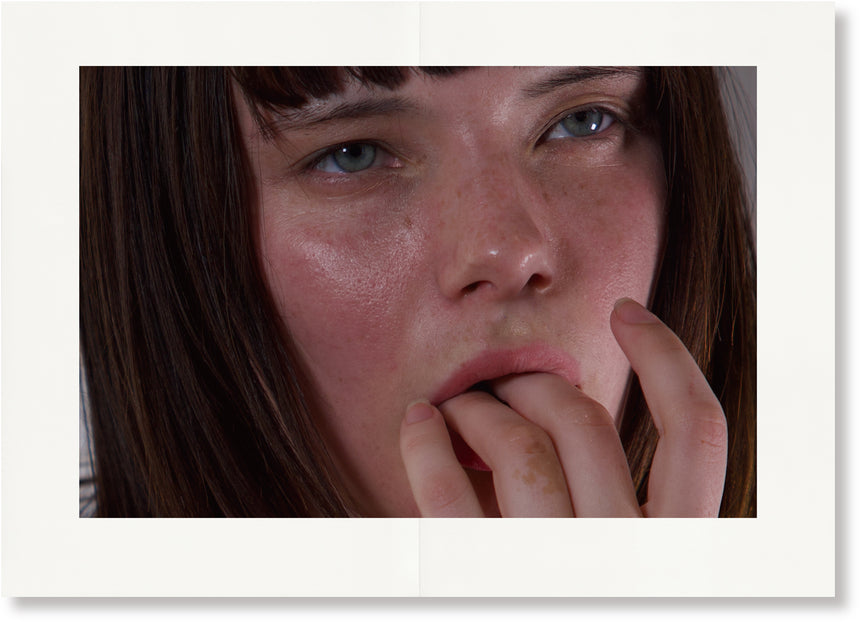 SPLINT<br>Chessa Subbiondo